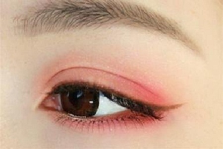 开眼角避免术后留疤主要哪些方面